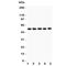 Hepatocyte Nuclear Factor 4 Alpha antibody, R31628, NSJ Bioreagents, Western Blot image 