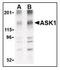 Mitogen-Activated Protein Kinase Kinase Kinase 5 antibody, LS-B3206, Lifespan Biosciences, Western Blot image 