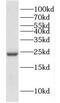 Deoxyuridine 5 -triphosphate nucleotidohydrolase, mitochondrial antibody, FNab02572, FineTest, Western Blot image 