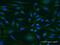 Immunoglobulin superfamily DCC subclass member 4 antibody, H00057722-M05, Novus Biologicals, Immunocytochemistry image 