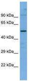 High affinity choline transporter 1 antibody, TA333720, Origene, Western Blot image 