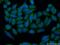Glutathione S-Transferase Mu 1 antibody, 12412-1-AP, Proteintech Group, Immunofluorescence image 