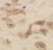 Centrosome-associated protein CEP250 antibody, FNab01601, FineTest, Immunohistochemistry paraffin image 
