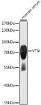 Vitronectin antibody, LS-C748608, Lifespan Biosciences, Western Blot image 