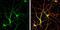 Cyclin-dependent kinase 5 activator 1 antibody, GTX133713, GeneTex, Immunocytochemistry image 