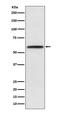 Lecithin-Cholesterol Acyltransferase antibody, M00906, Boster Biological Technology, Western Blot image 