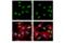 Replication Protein A2 antibody, 35869T, Cell Signaling Technology, Immunofluorescence image 