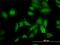Protein Disulfide Isomerase Family A Member 5 antibody, H00010954-M01, Novus Biologicals, Immunocytochemistry image 
