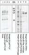 Integrin Subunit Beta 1 antibody, GTX25185, GeneTex, Western Blot image 