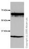 Interleukin 4 Induced 1 antibody, ab18524, Abcam, Western Blot image 