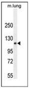 PHD finger protein 12 antibody, AP53280PU-N, Origene, Western Blot image 