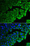 Ribosomal Protein Lateral Stalk Subunit P0 antibody, 19-730, ProSci, Immunofluorescence image 