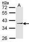 Eukaryotic Translation Elongation Factor 1 Delta antibody, PA5-27666, Invitrogen Antibodies, Western Blot image 