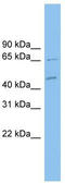 Malate Dehydrogenase 1B antibody, TA339976, Origene, Western Blot image 