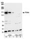 Integrin alpha-4 antibody, A305-255A, Bethyl Labs, Western Blot image 