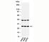 C-Type Lectin Domain Family 4 Member E antibody, N1058-100UG, NSJ Bioreagents, Western Blot image 