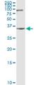 Zinc Finger Protein 253 antibody, H00056242-D01P, Novus Biologicals, Western Blot image 