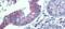Desmoglein 2 antibody, ARP45198_P050, Aviva Systems Biology, Immunohistochemistry frozen image 
