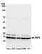 ADP Ribosylation Factor 6 antibody, A305-239A, Bethyl Labs, Western Blot image 