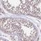 Chromosome 4 Open Reading Frame 47 antibody, NBP1-93540, Novus Biologicals, Immunohistochemistry paraffin image 