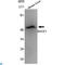 Beta-Secretase 1 antibody, LS-C812887, Lifespan Biosciences, Western Blot image 