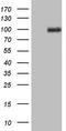 Protein Kinase D3 antibody, TA805724S, Origene, Western Blot image 