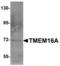 Anoctamin 1 antibody, TA306851, Origene, Western Blot image 