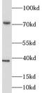 LIM Domain Kinase 1 antibody, FNab04780, FineTest, Western Blot image 