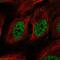 RAD52 Homolog, DNA Repair Protein antibody, NBP2-58116, Novus Biologicals, Immunofluorescence image 