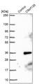 Chromosome 9 Open Reading Frame 135 antibody, PA5-54383, Invitrogen Antibodies, Western Blot image 