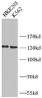 BUB1 Mitotic Checkpoint Serine/Threonine Kinase antibody, FNab00987, FineTest, Western Blot image 