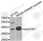 Adiponectin Receptor 1 antibody, A1509, ABclonal Technology, Western Blot image 