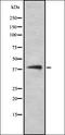 NFKB Inhibitor Interacting Ras Like 2 antibody, orb335390, Biorbyt, Western Blot image 