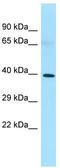 Progestin And AdipoQ Receptor Family Member 8 antibody, TA333551, Origene, Western Blot image 