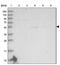 ZIP-8 antibody, NBP1-88605, Novus Biologicals, Western Blot image 