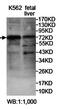 Zinc Finger Protein 564 antibody, orb78189, Biorbyt, Western Blot image 
