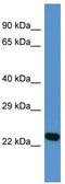 DnaJ Heat Shock Protein Family (Hsp40) Member A4 antibody, TA344846, Origene, Western Blot image 