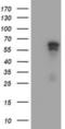 Adrenocortical dysplasia protein antibody, NBP2-01851, Novus Biologicals, Western Blot image 