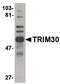 Tripartite motif-containing protein 30 antibody, PA5-20590, Invitrogen Antibodies, Western Blot image 