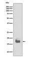 Interleukin 1 Beta antibody, M00101, Boster Biological Technology, Western Blot image 