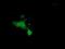 E3 ubiquitin-protein ligase MGRN1 antibody, NBP2-00586, Novus Biologicals, Immunocytochemistry image 
