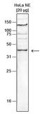 Lysine Methyltransferase 5A antibody, TA347288, Origene, Western Blot image 
