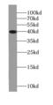 Survival Of Motor Neuron 2, Centromeric antibody, FNab08036, FineTest, Western Blot image 