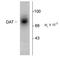 Sodium-dependent dopamine transporter antibody, TA309112, Origene, Western Blot image 