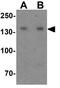 WAPL Cohesin Release Factor antibody, GTX31577, GeneTex, Western Blot image 