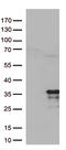 Mitochondrial Ribosomal Protein L24 antibody, M15563, Boster Biological Technology, Western Blot image 