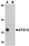 Autophagy Related 12 antibody, LS-B3216, Lifespan Biosciences, Western Blot image 