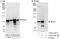 Interleukin 1 Receptor Associated Kinase 1 antibody, A303-744A, Bethyl Labs, Immunoprecipitation image 