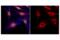 RAB7A, Member RAS Oncogene Family antibody, 17286S, Cell Signaling Technology, Immunofluorescence image 