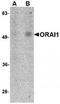 ORAI Calcium Release-Activated Calcium Modulator 1 antibody, TA320060, Origene, Western Blot image 